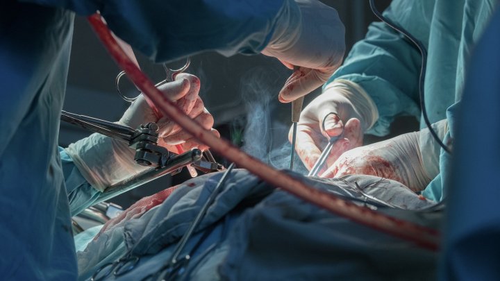 В Турции хирурги извлекли из желудка пациентки забытое три года назад полотенце