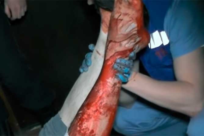 Женщина получила ножевое ранение ноги во время ссоры из-за ревности